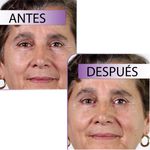 SERUM FACIAL ARRUGAS LISHE X2_A