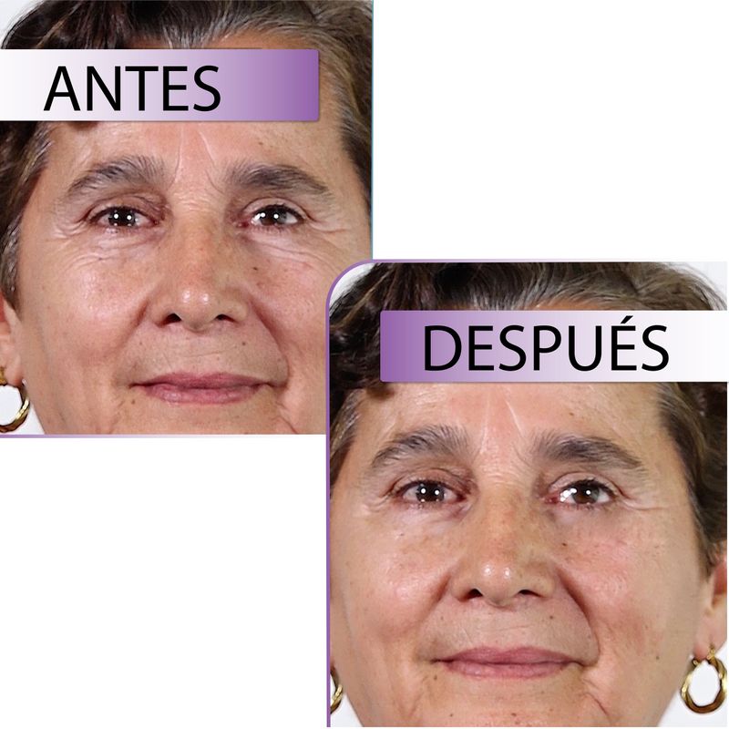 SERUM FACIAL ARRUGAS LISHE X2_A