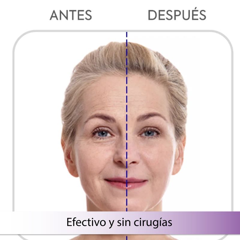 SERUM FACIAL ARRUGAS LISHE X2_C