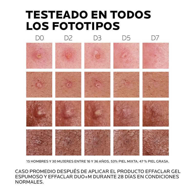 TRATAMIENTO CORRECTOR ANTIIMPE_A